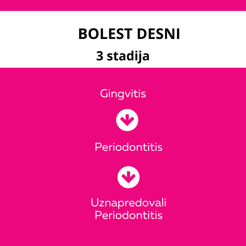 3 stadija bolesti desni
